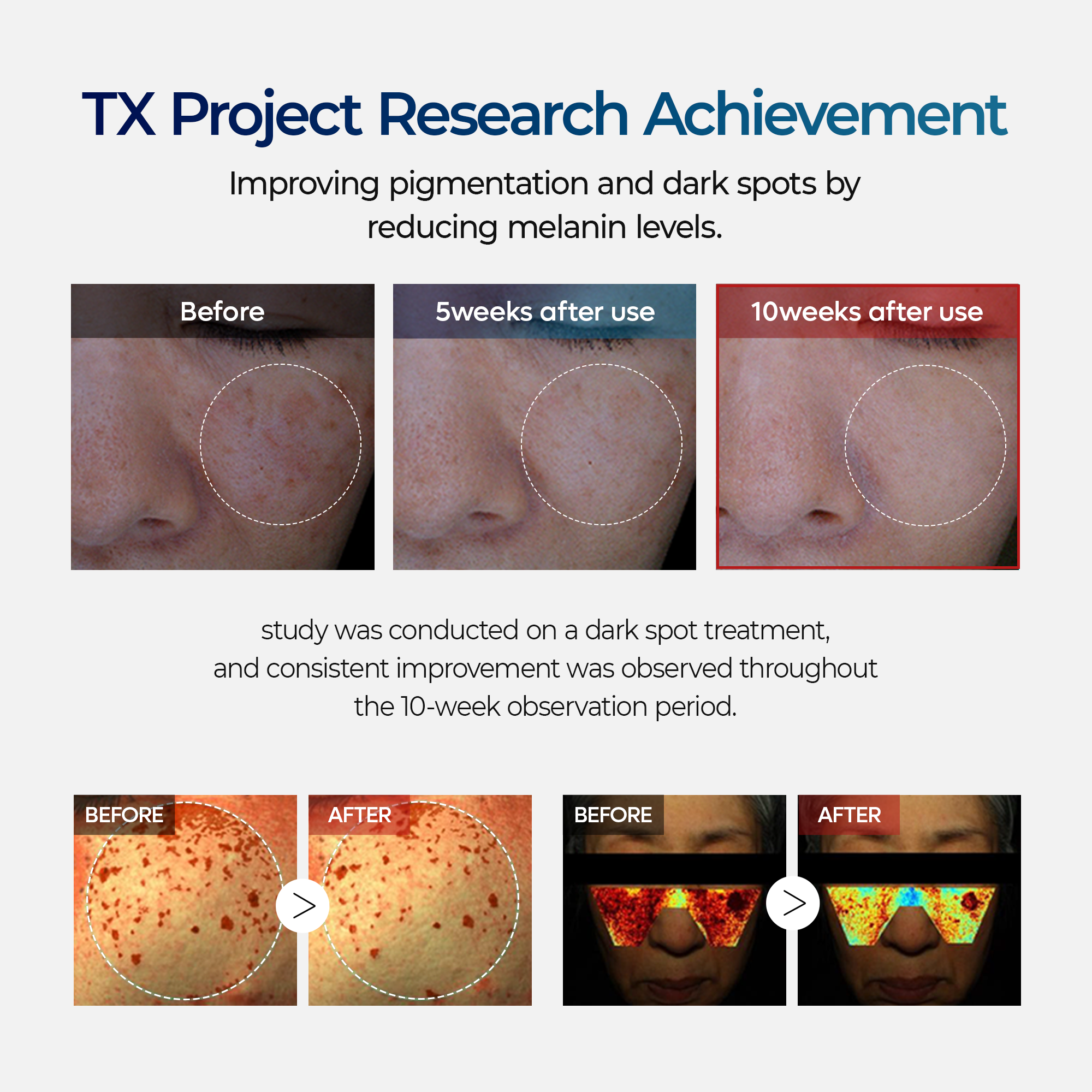 TX Cream detail view 7 — Dr Melaxin K-Beauty