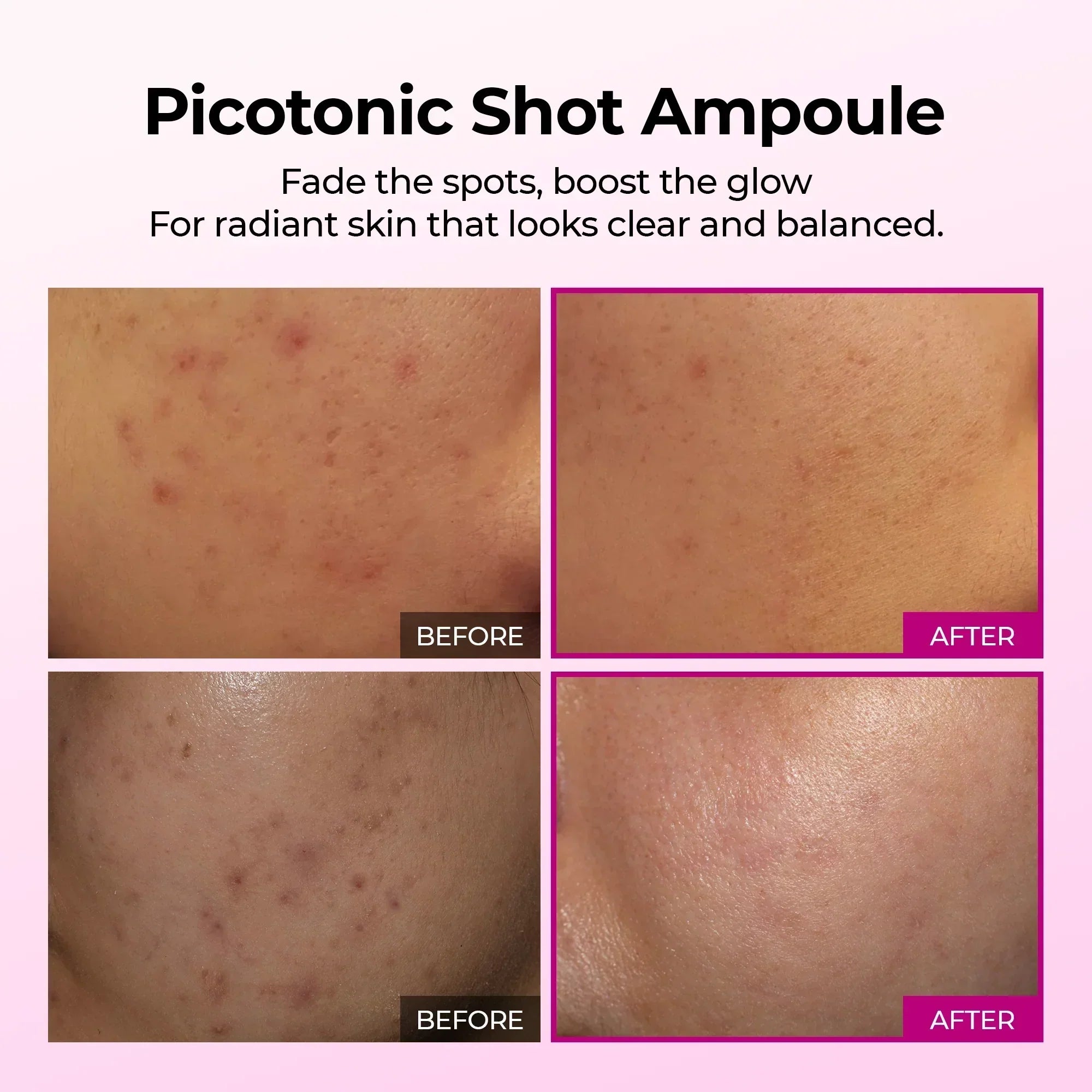 Picotonic Shot Pigmentation Ampoule detail view 5 — Dr Melaxin K-Beauty