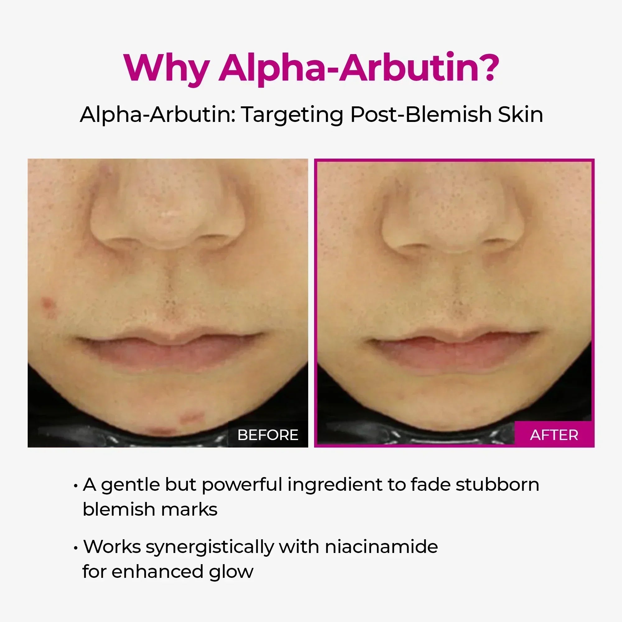 Pigmentation Duo — Picotonic + Multi Balm detail view 4 — Dr Melaxin K-Beauty