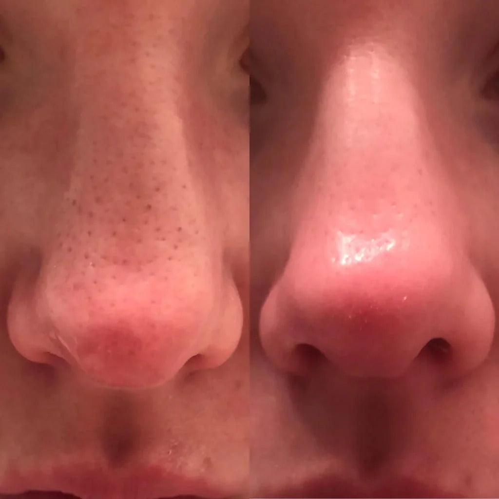 Glass Skin Essential Kit (5 pcs) detail view 6 — Dr Melaxin K-Beauty