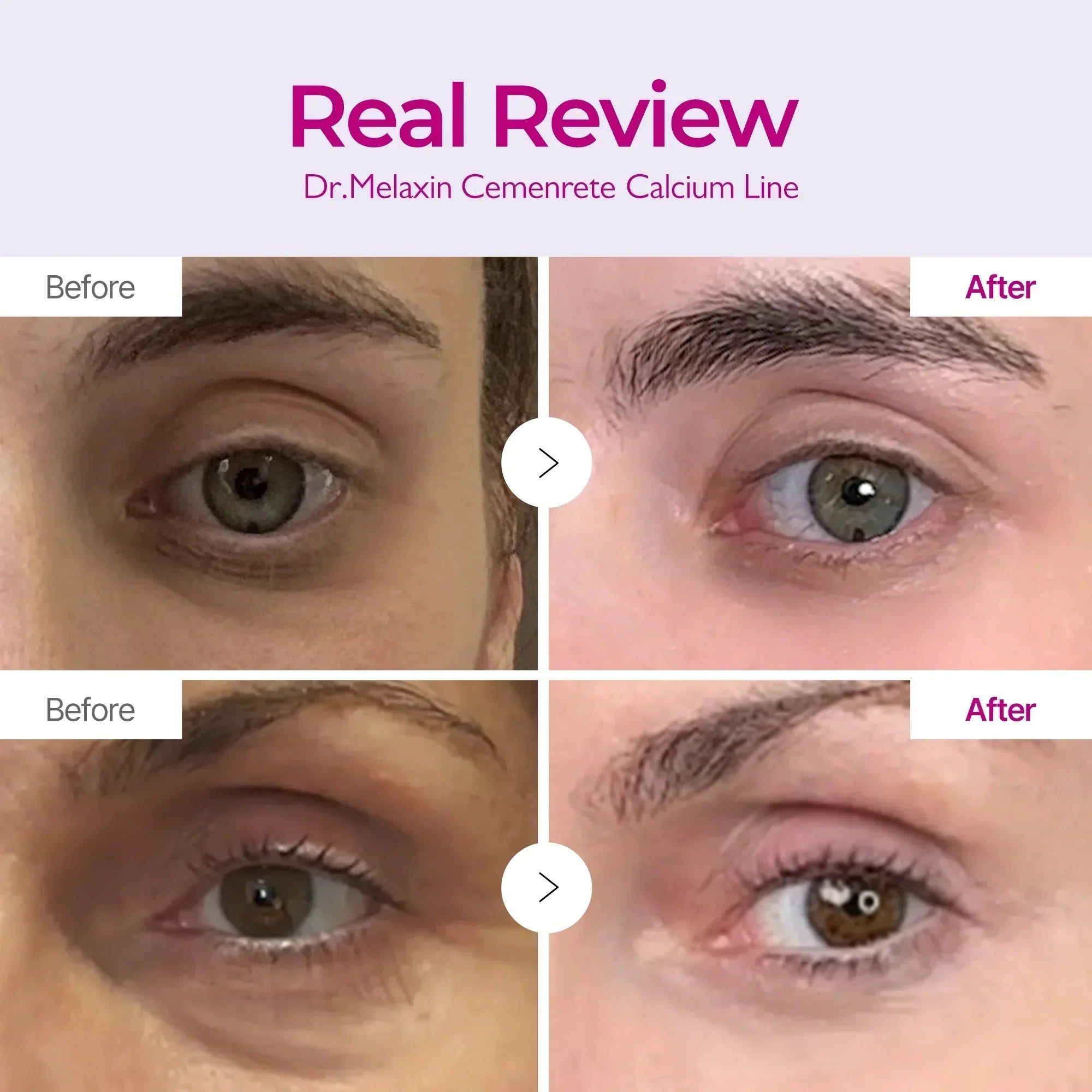 Cemenrete Calcium Intense Cream detail view 4 — Dr Melaxin K-Beauty