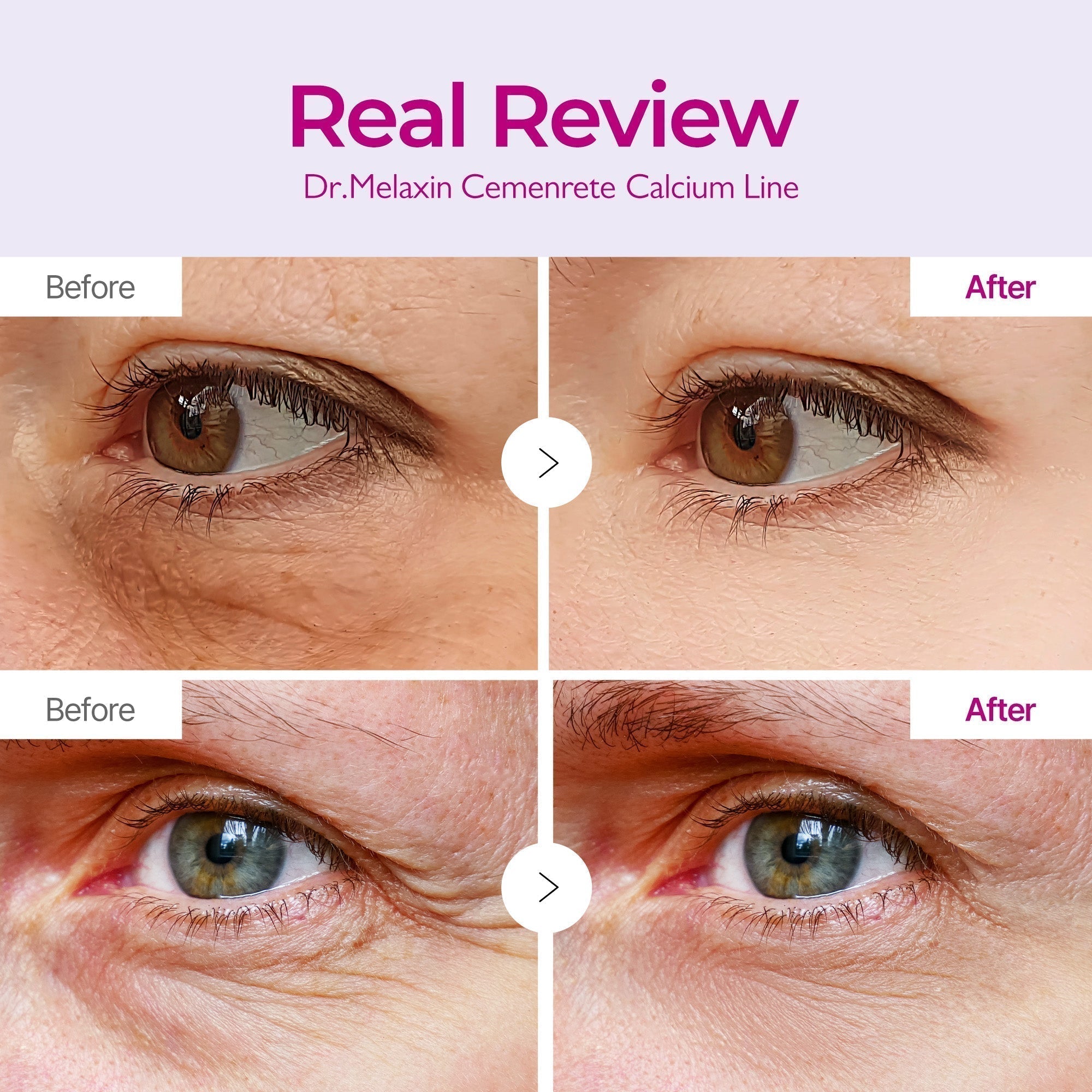 Dr. Melaxin Eye Care Complete Routine detail view 3 — Dr Melaxin K-Beauty