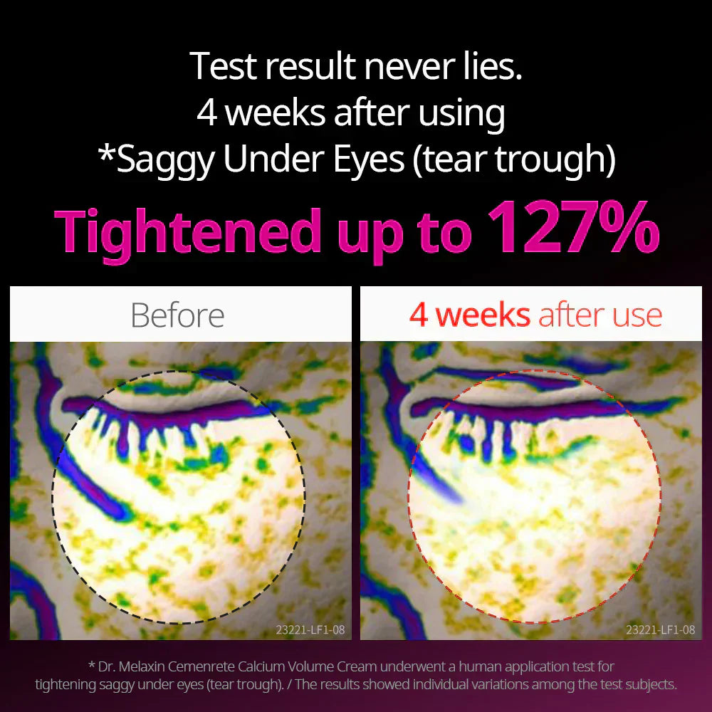 Cemenrete Eye care Line detail view 3 — Dr Melaxin K-Beauty