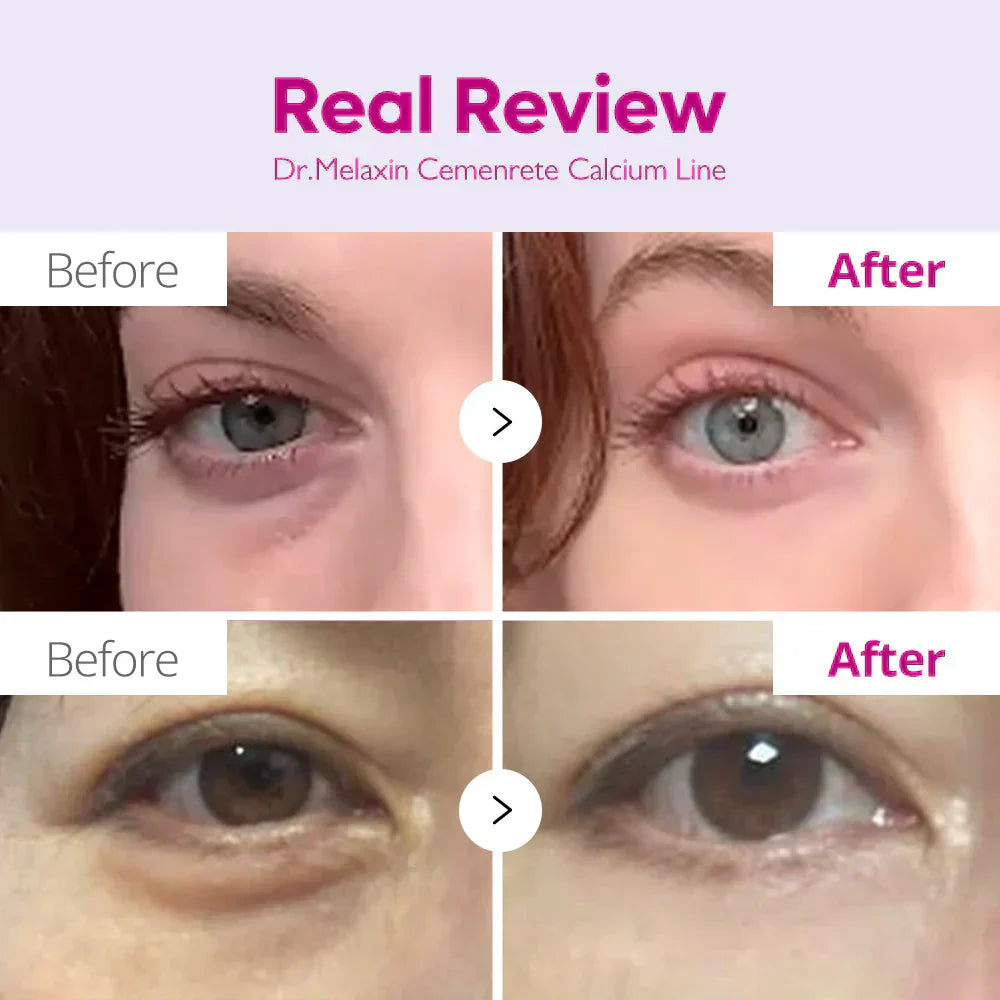 Cemenrete Eye care Line detail view 4 — Dr Melaxin K-Beauty