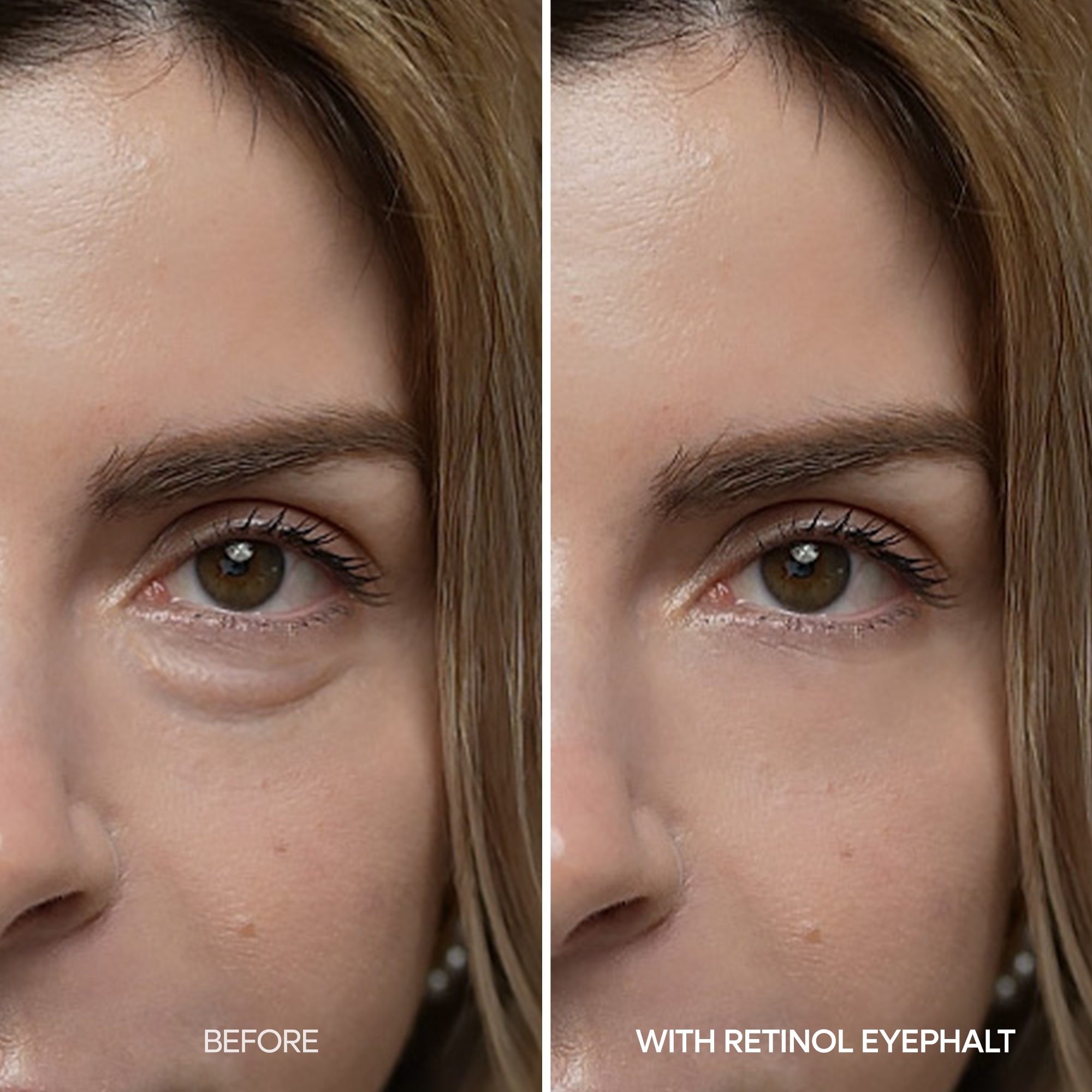 [FLASH 1+1 DEAL] Retinol Eyebag Cream detail view 4 — Dr Melaxin K-Beauty