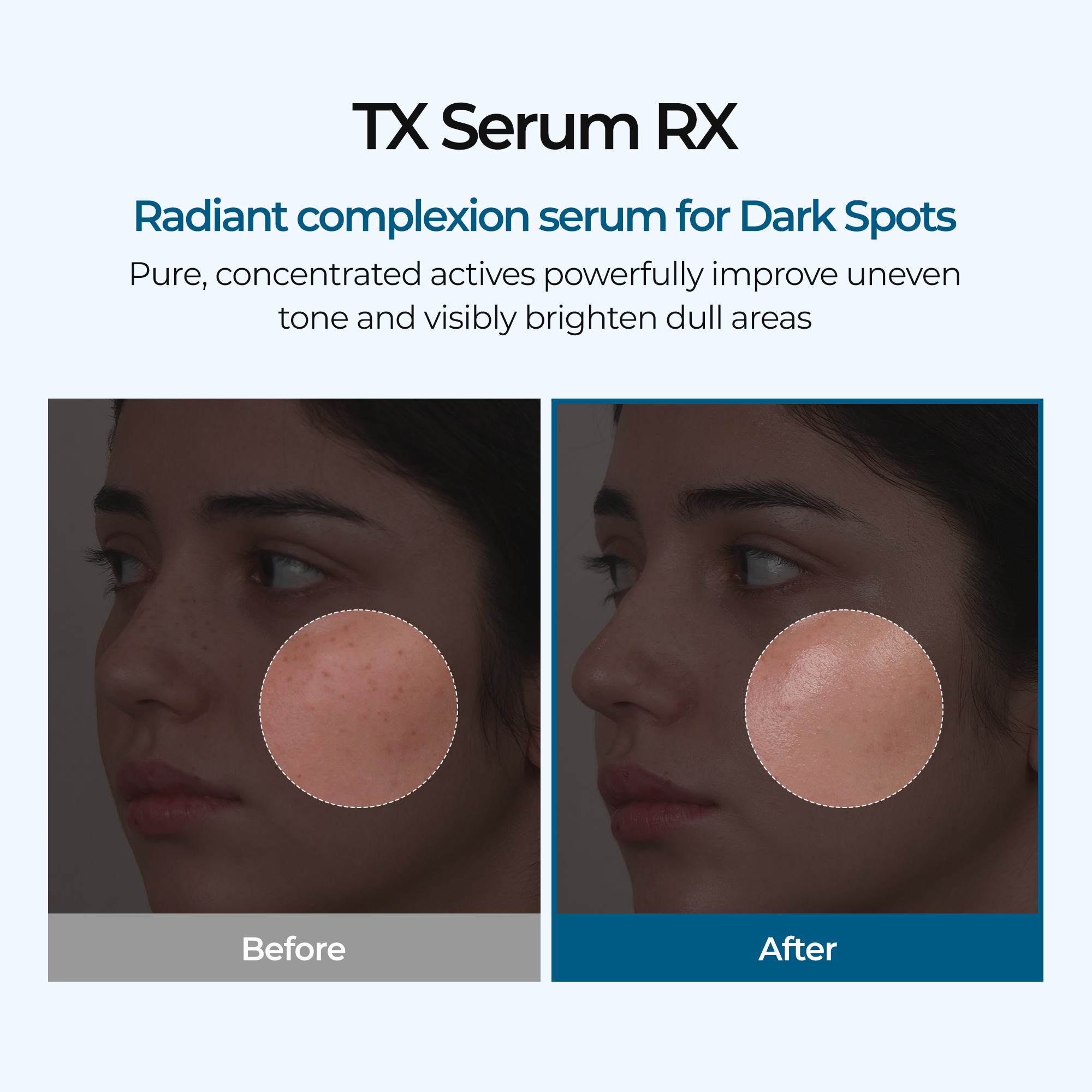 TX Ampoule Rx alternate angle — Dr Melaxin K-Beauty