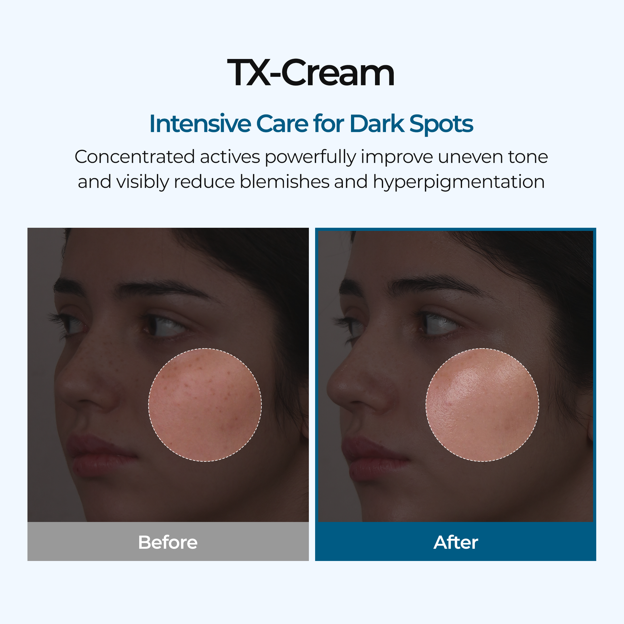 TX Cream detail view 4 — Dr Melaxin K-Beauty