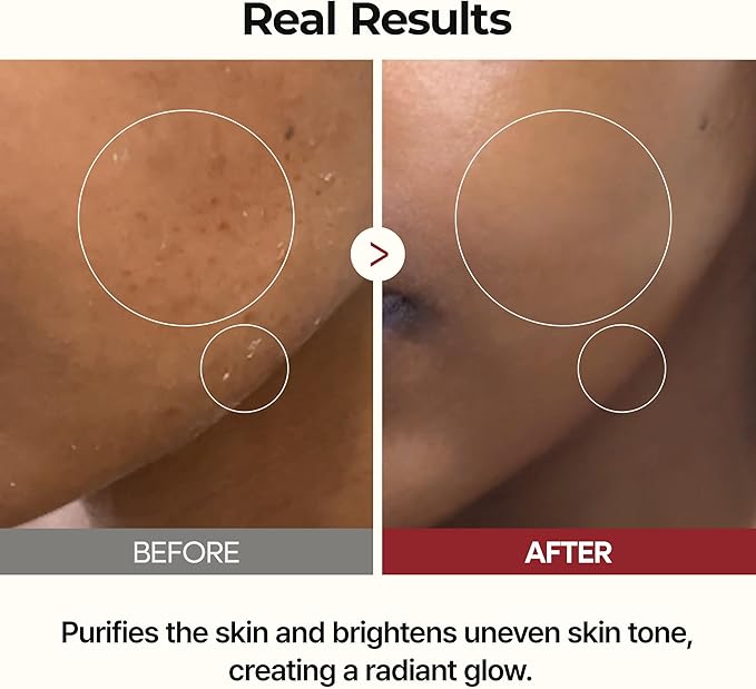 Dr. Melaxin Rice Peel Ampoule alternate angle — Dr Melaxin K-Beauty