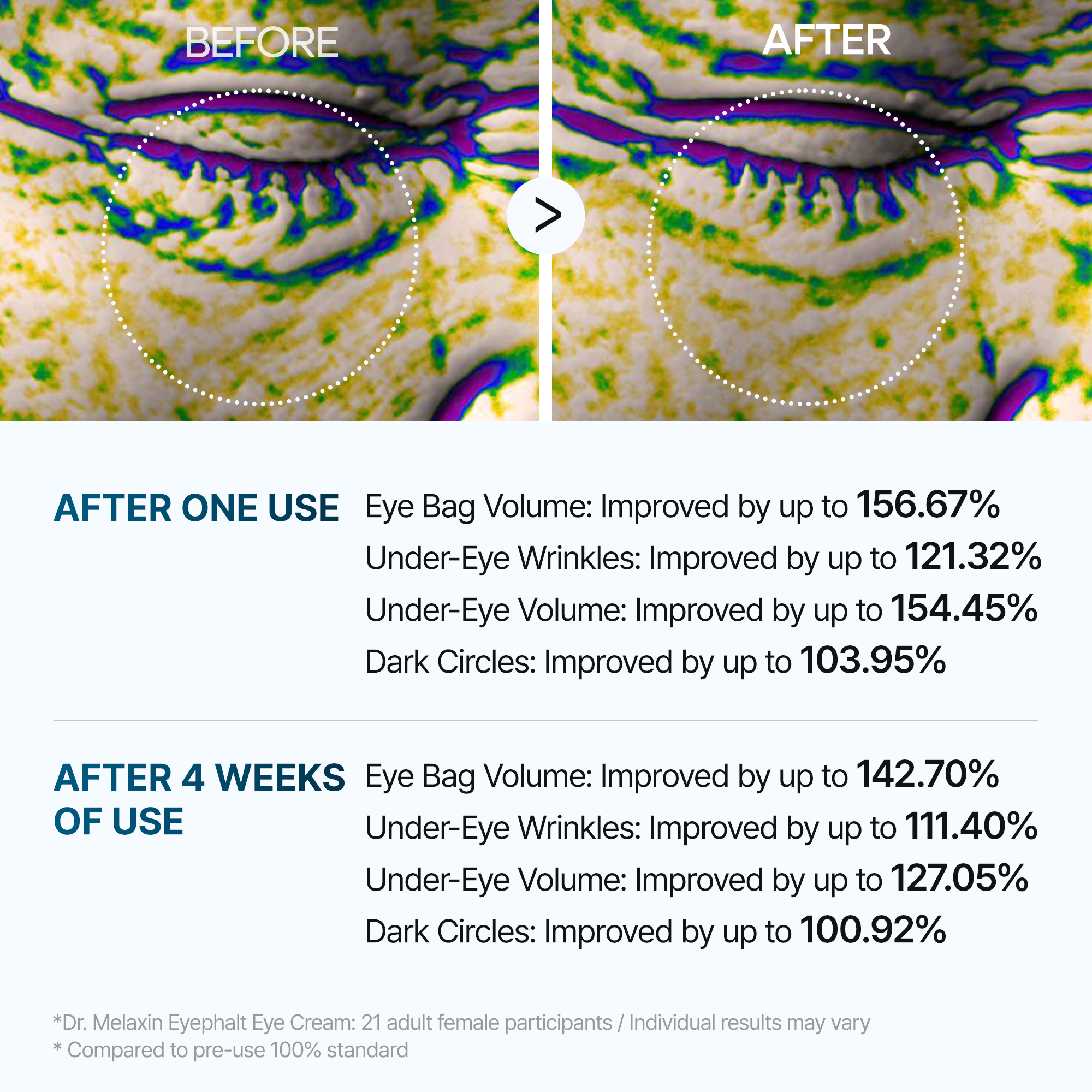 [SPECIAL 1+1 DEAL] Eyephalt eyebag cream detail view 5 — Dr Melaxin K-Beauty