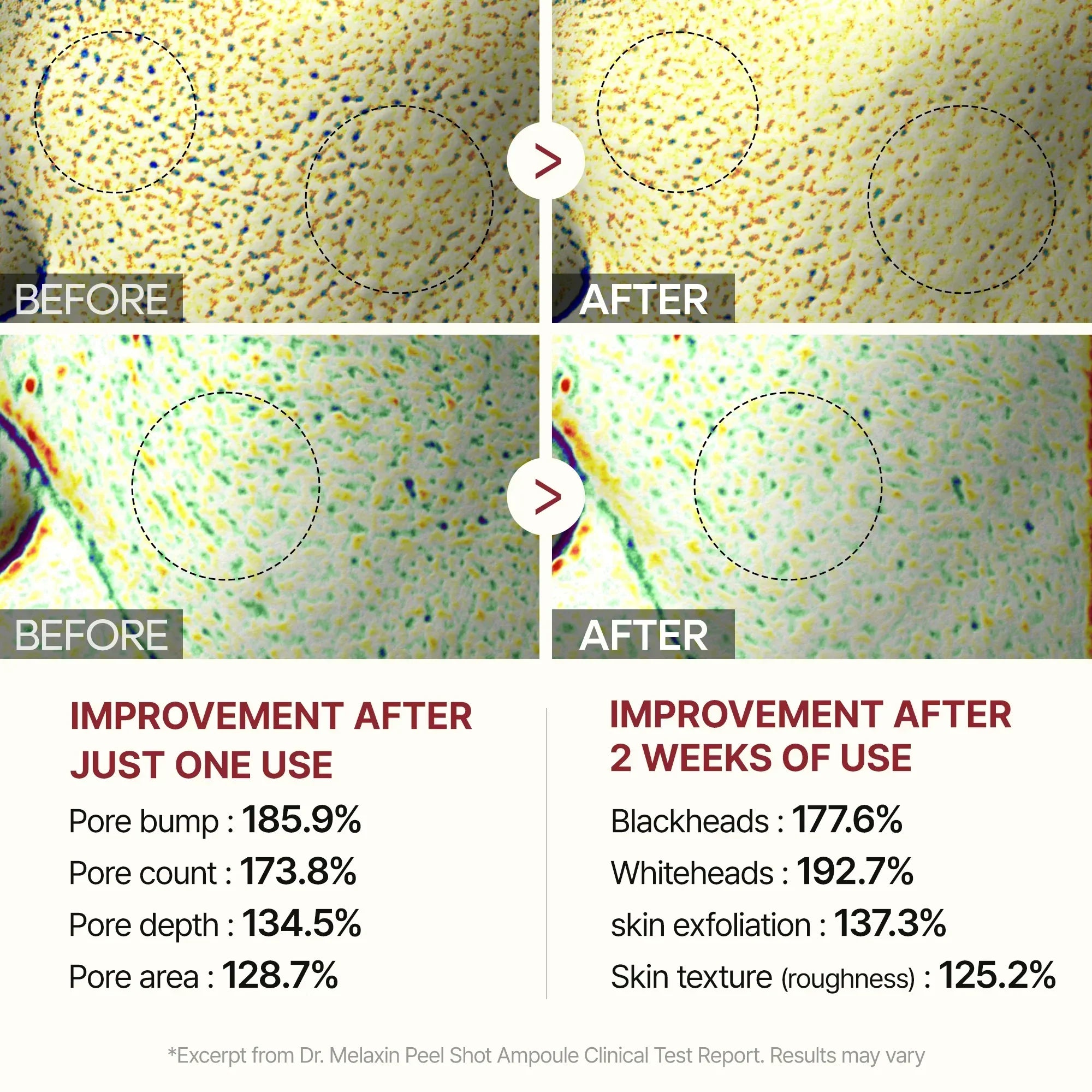 Peel Shot Glow Rice Line detail view 11 — Dr Melaxin K-Beauty