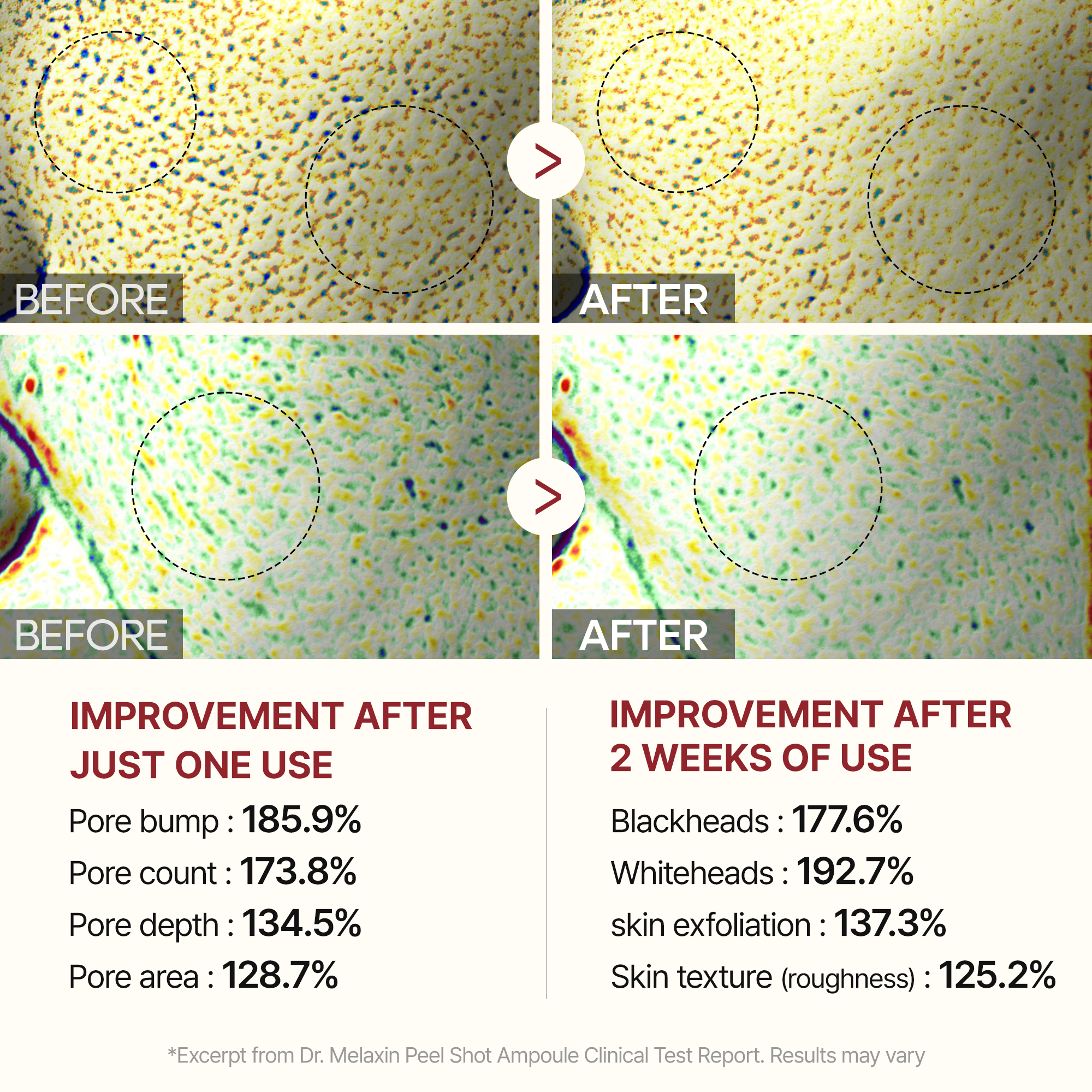 Peel Shot Trio Complete detail view 6 — Dr Melaxin K-Beauty