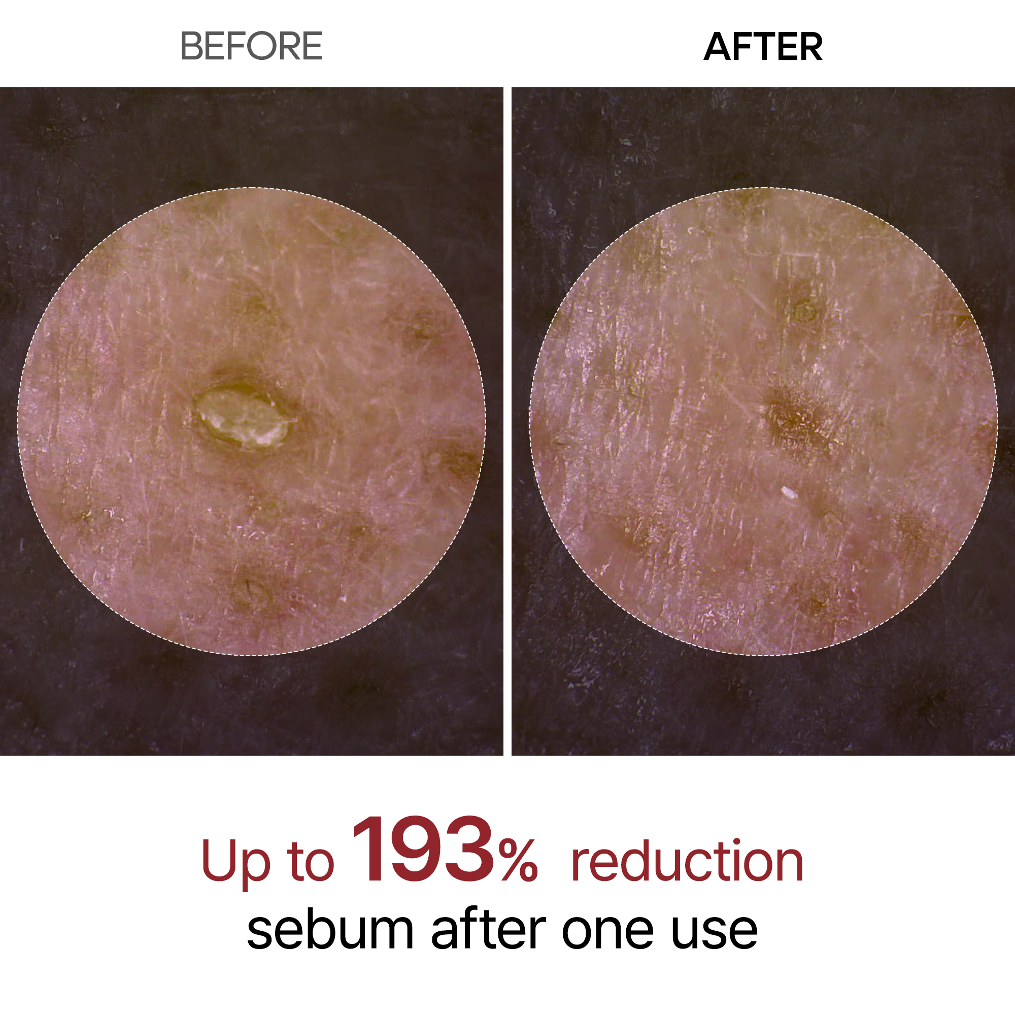Peel Shot Trio Complete detail view 3 — Dr Melaxin K-Beauty