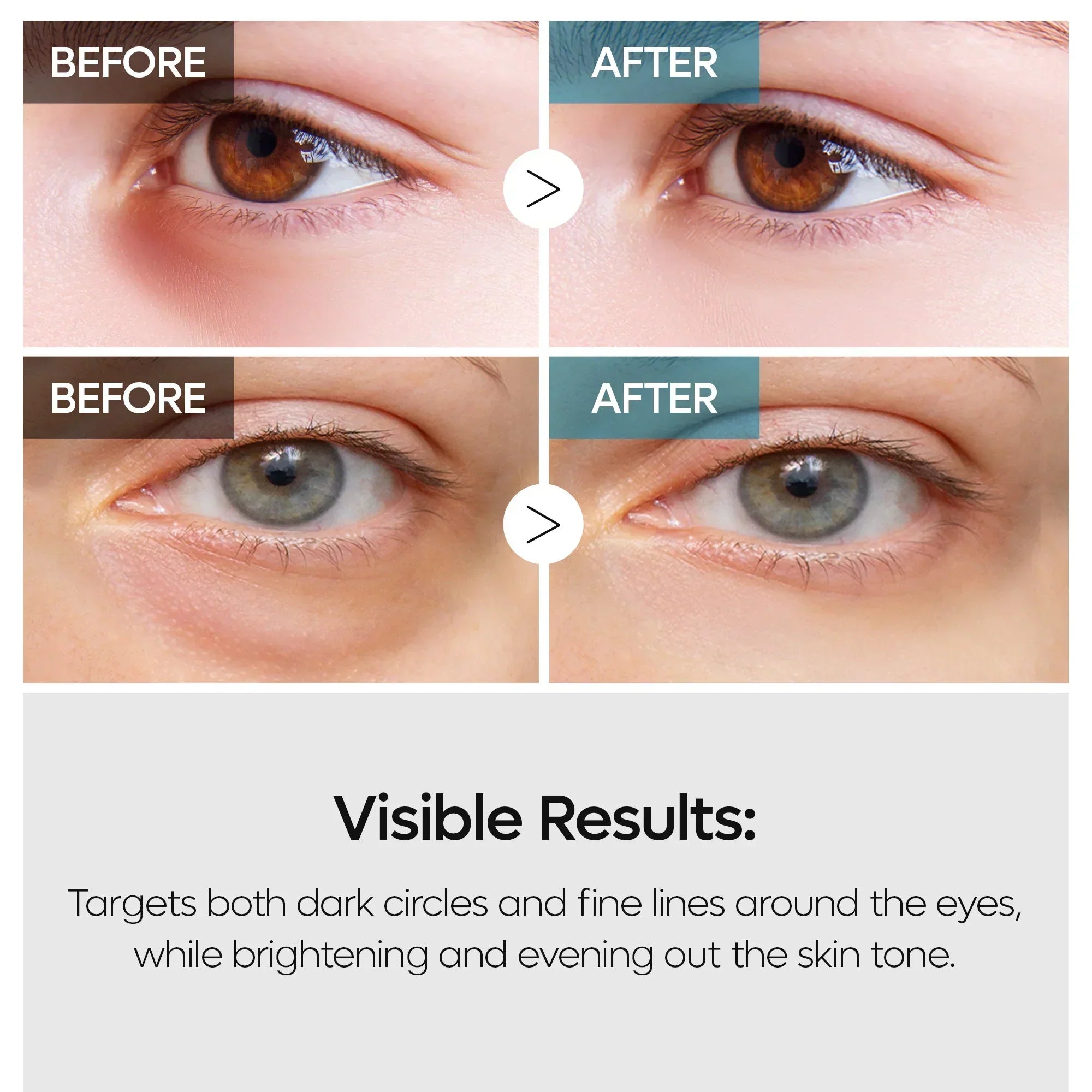TX Retinalsome Double Effect Eyecream detail view 4 — Dr Melaxin K-Beauty