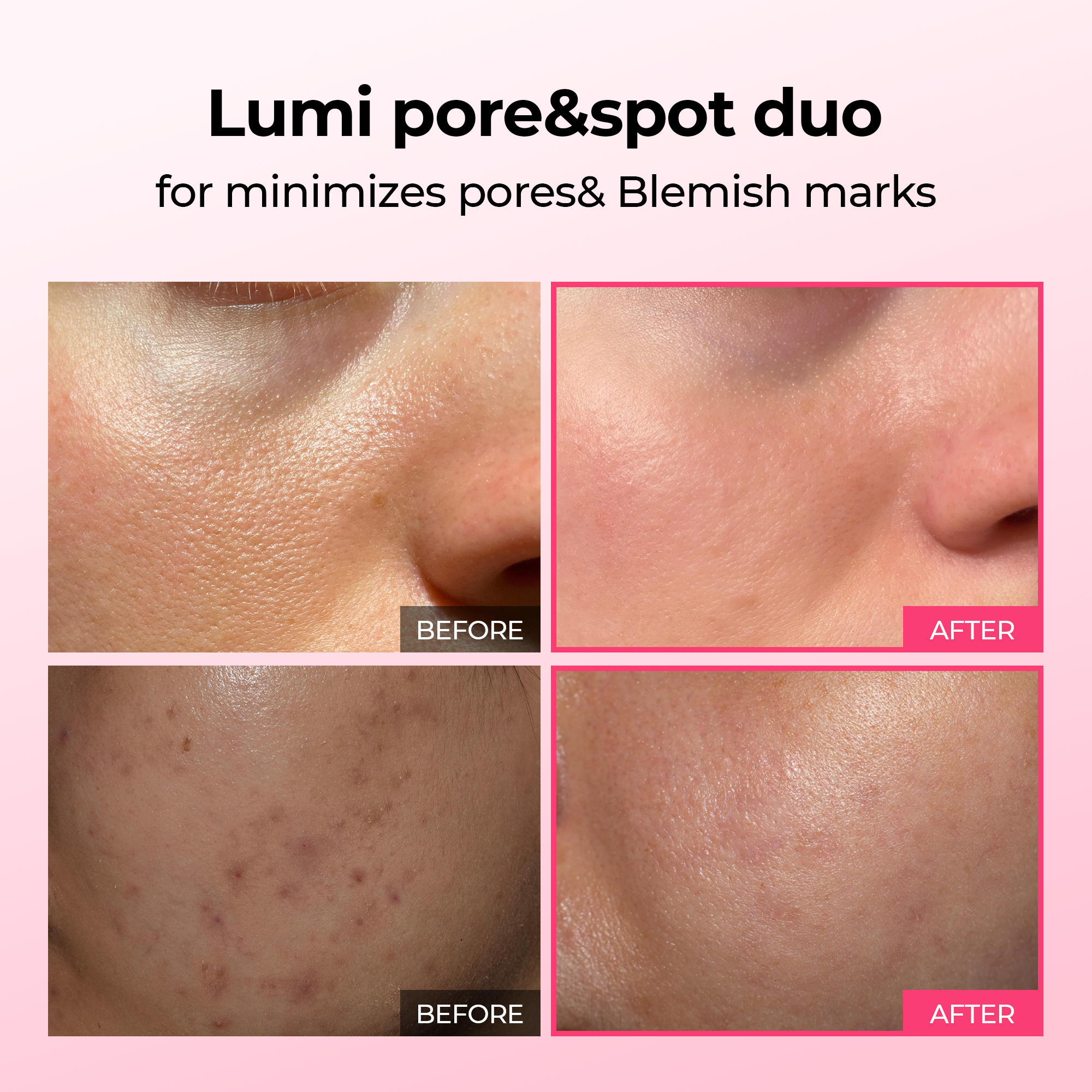 Lumi Pore & Spot Care Duo alternate angle — Dr Melaxin K-Beauty