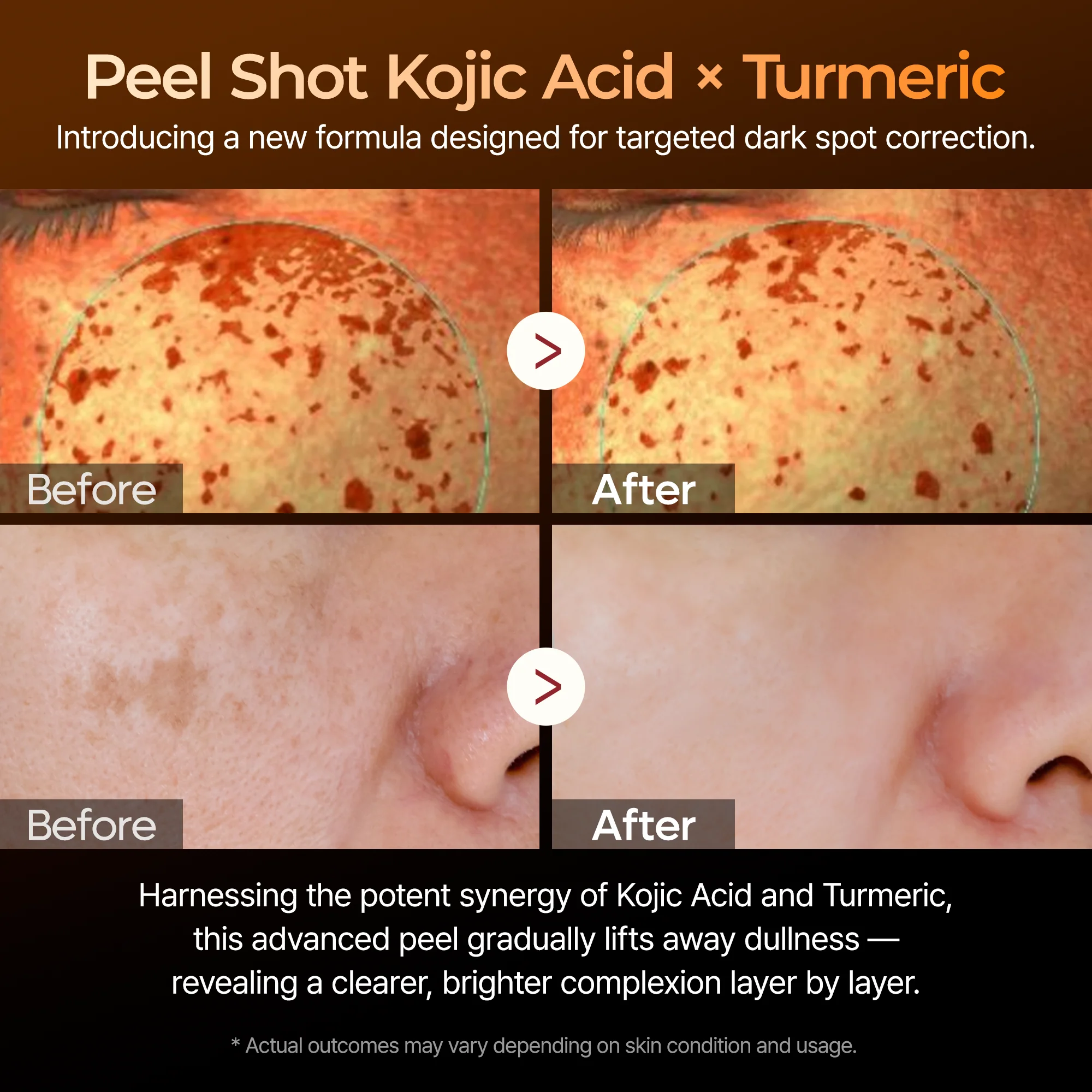 Peel Shot kojic Acid Turmeric Serum detail view 3 — Dr Melaxin K-Beauty
